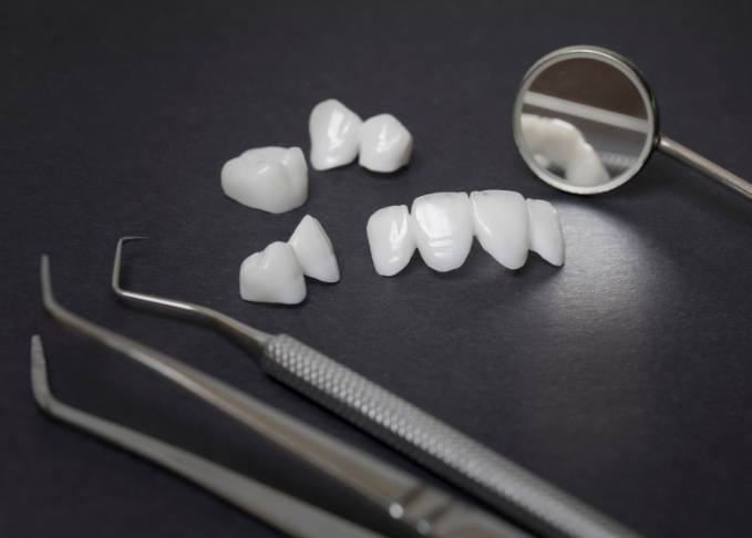 Several white dental crowns and veneers on table with dental instruments
